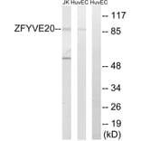 Western Blot - Anti-ZFYVE20 Antibody (C18130) - Antibodies.com