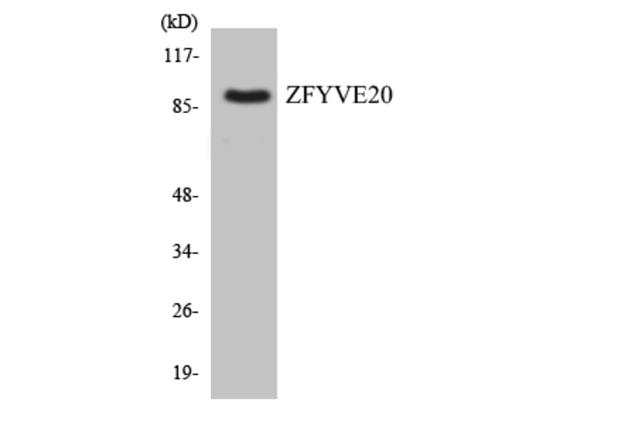 Western Blot - Anti-ZFYVE20 Antibody (R12-3693) - Antibodies.com