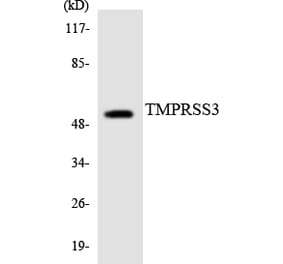 Western Blot - Anti-TMPRSS3 Antibody (R12-3633) - Antibodies.com