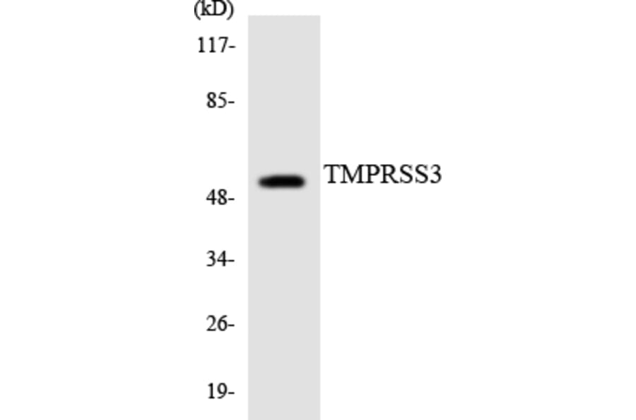 Western Blot - Anti-TMPRSS3 Antibody (R12-3633) - Antibodies.com