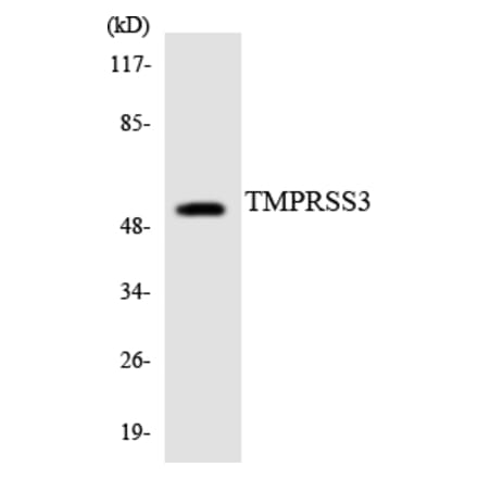 Western Blot - Anti-TMPRSS3 Antibody (R12-3633) - Antibodies.com