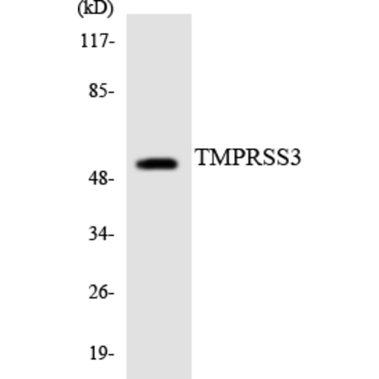 Western Blot - Anti-TMPRSS3 Antibody (R12-3633) - Antibodies.com