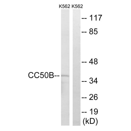 Western Blot - Anti-TMEM30B Antibody (C12119) - Antibodies.com