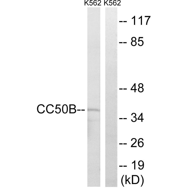 Western Blot - Anti-TMEM30B Antibody (C12119) - Antibodies.com