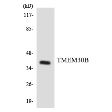 Western Blot - Anti-TMEM30B Antibody (R12-3632) - Antibodies.com