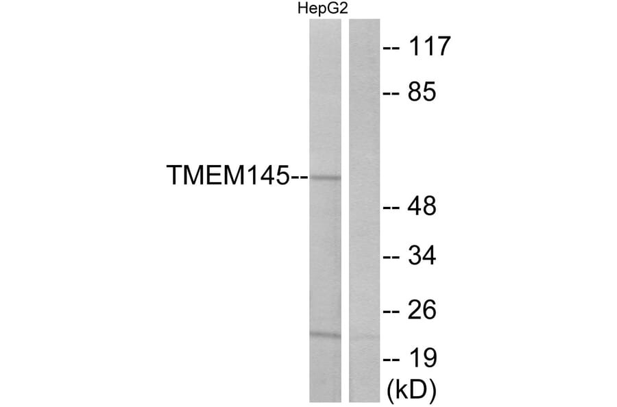 Western Blot - Anti-TMEM145 Antibody (G775) - Antibodies.com