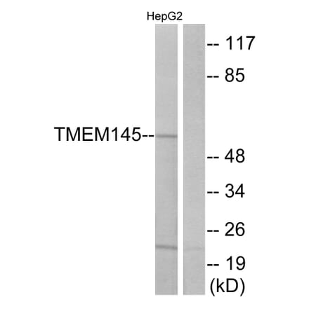 Western Blot - Anti-TMEM145 Antibody (G775) - Antibodies.com