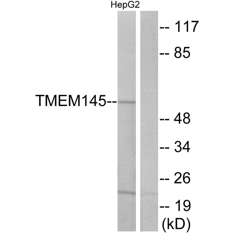Western Blot - Anti-TMEM145 Antibody (G775) - Antibodies.com