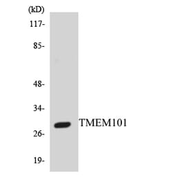 Western Blot - Anti-TMEM101 Antibody (R12-3630) - Antibodies.com