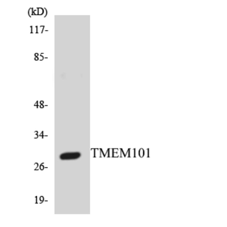 Western Blot - Anti-TMEM101 Antibody (R12-3630) - Antibodies.com