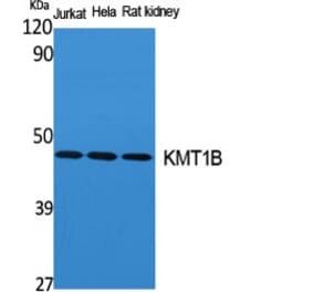 Western Blot - Anti-SUV39H2 Antibody (C20905) - Antibodies.com