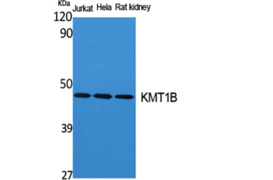 Western Blot - Anti-SUV39H2 Antibody (C20905) - Antibodies.com