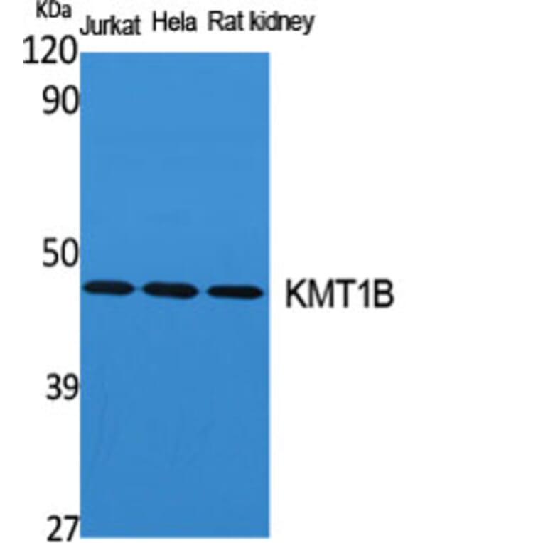 Western Blot - Anti-SUV39H2 Antibody (C20905) - Antibodies.com