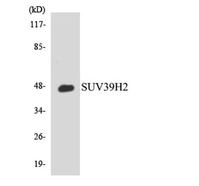 Western Blot - Anti-SUV39H2 Antibody (R12-3575) - Antibodies.com