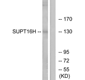 Western Blot - Anti-SUPT16H Antibody (C11966) - Antibodies.com
