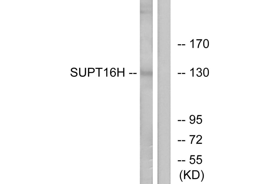 Western Blot - Anti-SUPT16H Antibody (C11966) - Antibodies.com