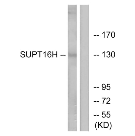 Western Blot - Anti-SUPT16H Antibody (C11966) - Antibodies.com