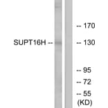 Western Blot - Anti-SUPT16H Antibody (C11966) - Antibodies.com