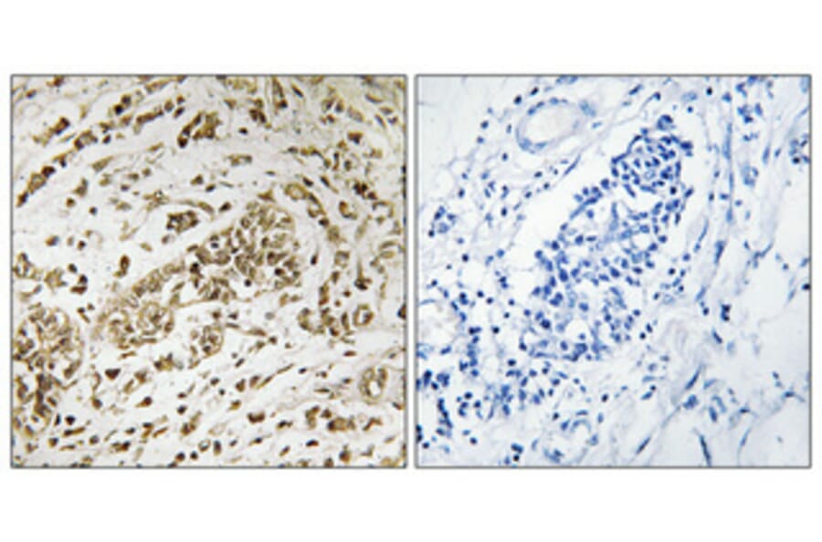 Immunohistochemistry - Anti-SUPT16H Antibody (C11966) - Antibodies.com