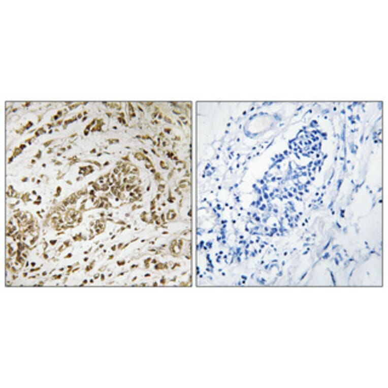 Immunohistochemistry - Anti-SUPT16H Antibody (C11966) - Antibodies.com