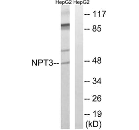 Western Blot - Anti-SLC17A2 Antibody (C18869) - Antibodies.com