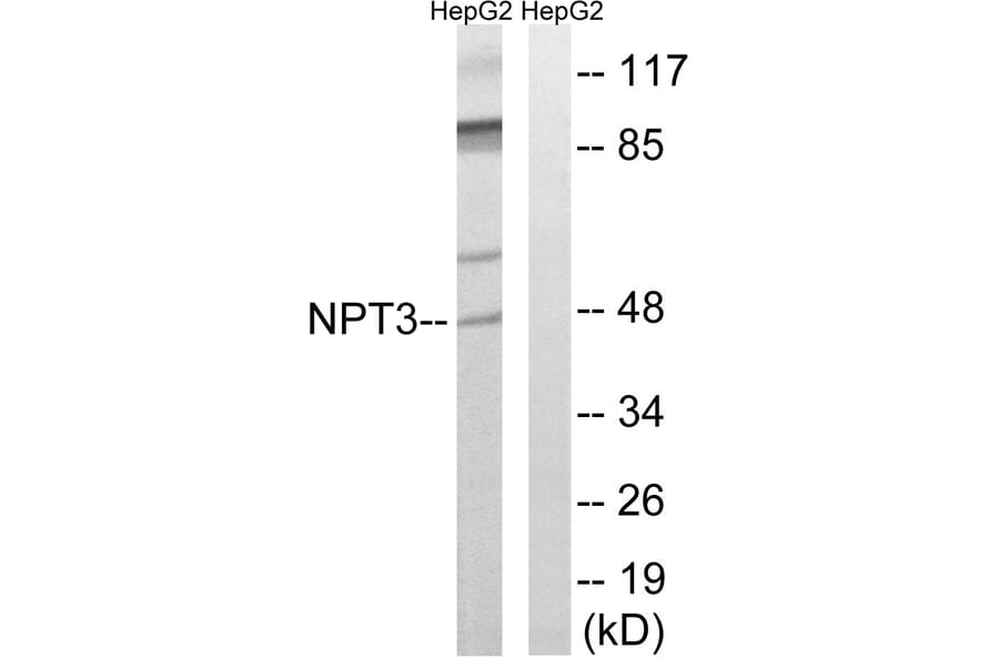 Western Blot - Anti-SLC17A2 Antibody (C18869) - Antibodies.com