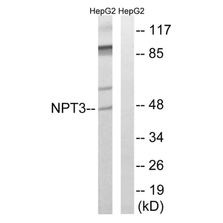 Western Blot - Anti-SLC17A2 Antibody (C18869) - Antibodies.com