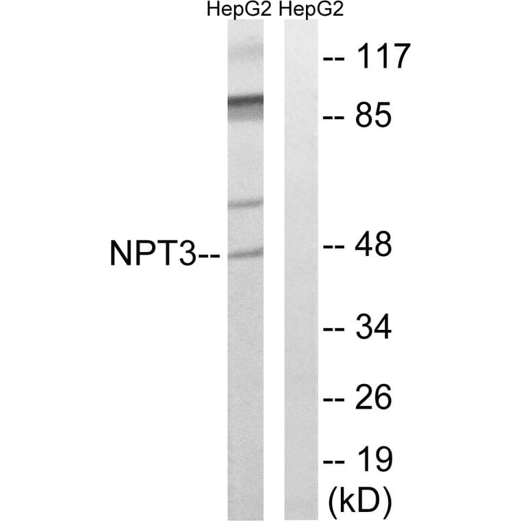 Western Blot - Anti-SLC17A2 Antibody (C18869) - Antibodies.com