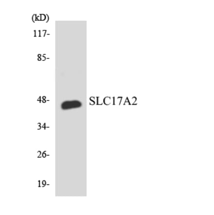 Western Blot - Anti-SLC17A2 Antibody (R12-3514) - Antibodies.com