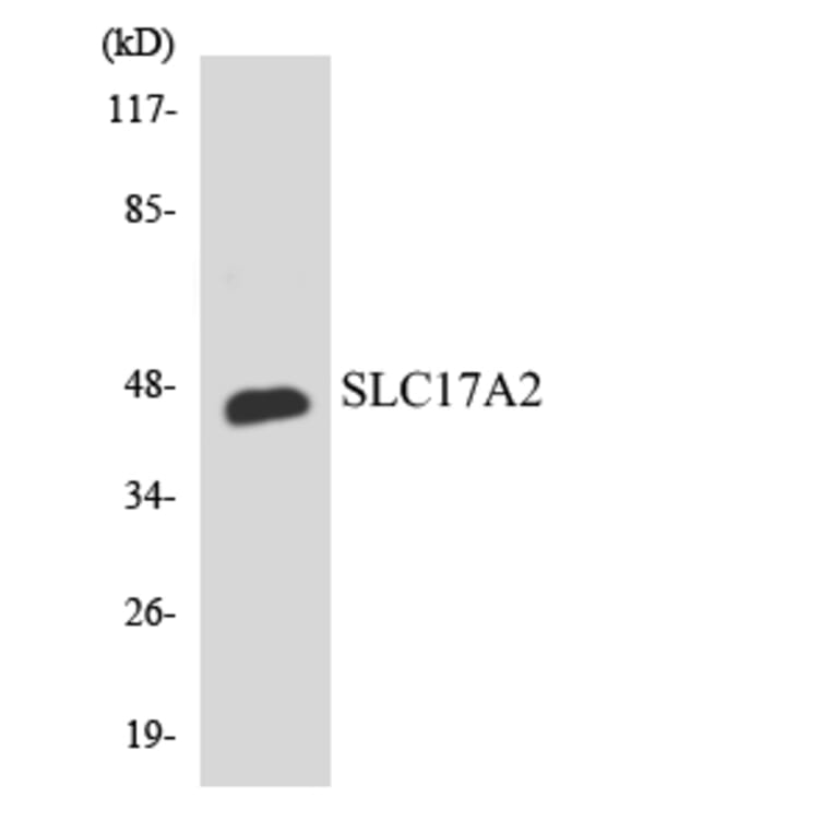 Western Blot - Anti-SLC17A2 Antibody (R12-3514) - Antibodies.com
