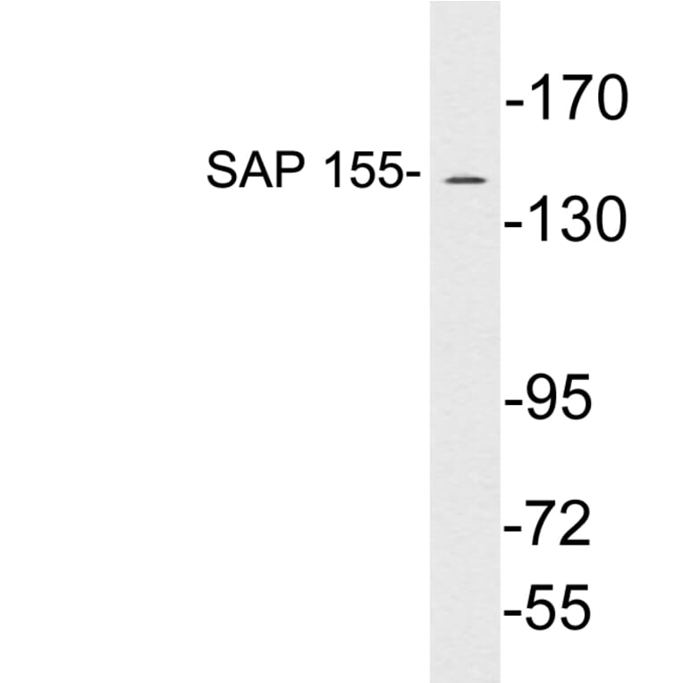 Western Blot - Anti-SAP 155 Antibody (R12-2344) - Antibodies.com
