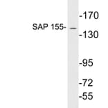 Western Blot - Anti-SAP 155 Antibody (R12-2344) - Antibodies.com