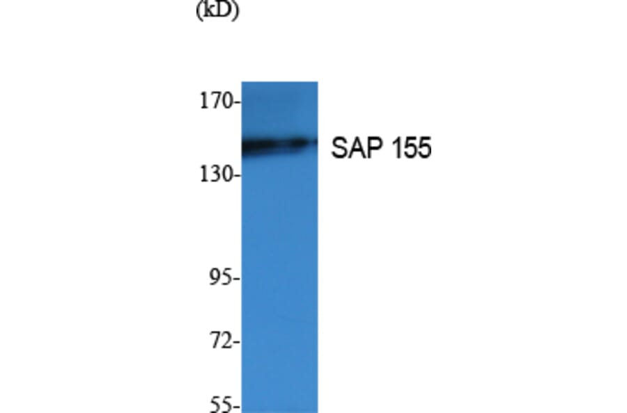 Western Blot - Anti-SAP 155 Antibody (R12-2344) - Antibodies.com