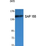 Western Blot - Anti-SAP 155 Antibody (R12-2344) - Antibodies.com
