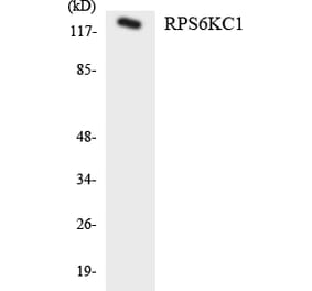 Western Blot - Anti-RPS6KC1 Antibody (R12-3465) - Antibodies.com