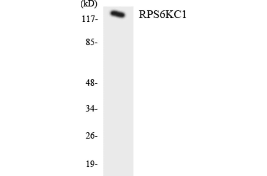 Western Blot - Anti-RPS6KC1 Antibody (R12-3465) - Antibodies.com