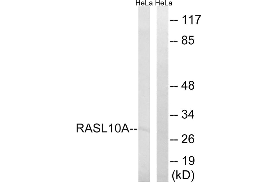 Western Blot - Anti-RASL10A Antibody (C18205) - Antibodies.com