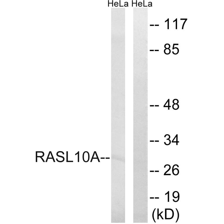 Western Blot - Anti-RASL10A Antibody (C18205) - Antibodies.com