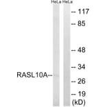 Western Blot - Anti-RASL10A Antibody (C18205) - Antibodies.com