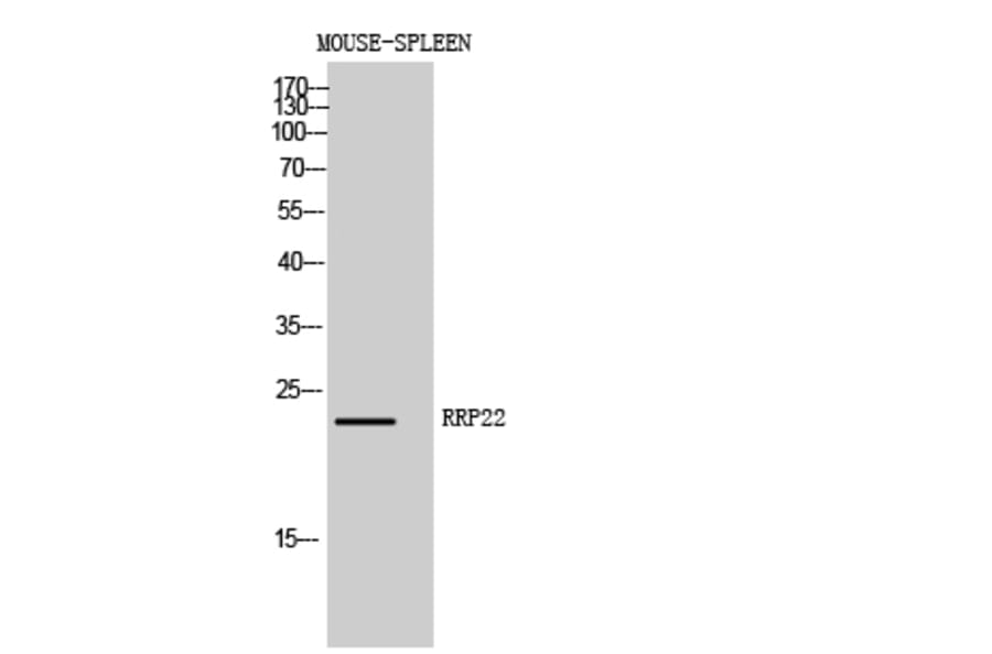 Western Blot - Anti-RASL10A Antibody (C18205) - Antibodies.com
