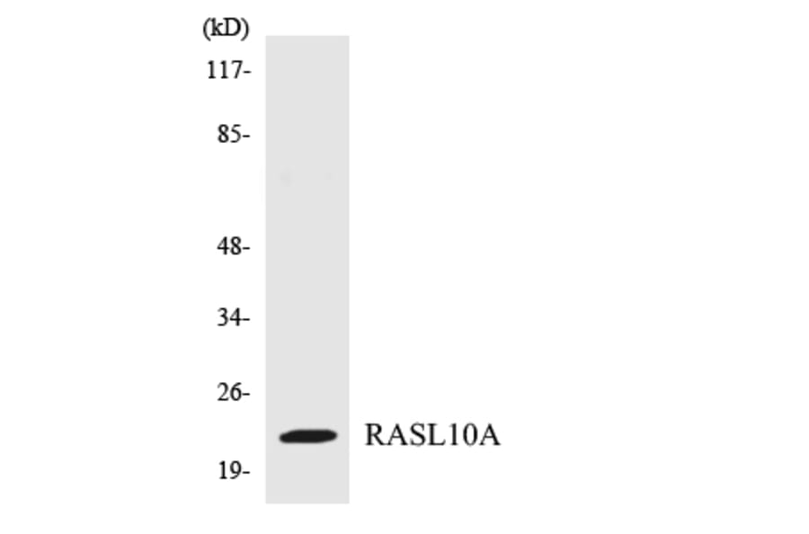 Western Blot - Anti-RASL10A Antibody (R12-3408) - Antibodies.com