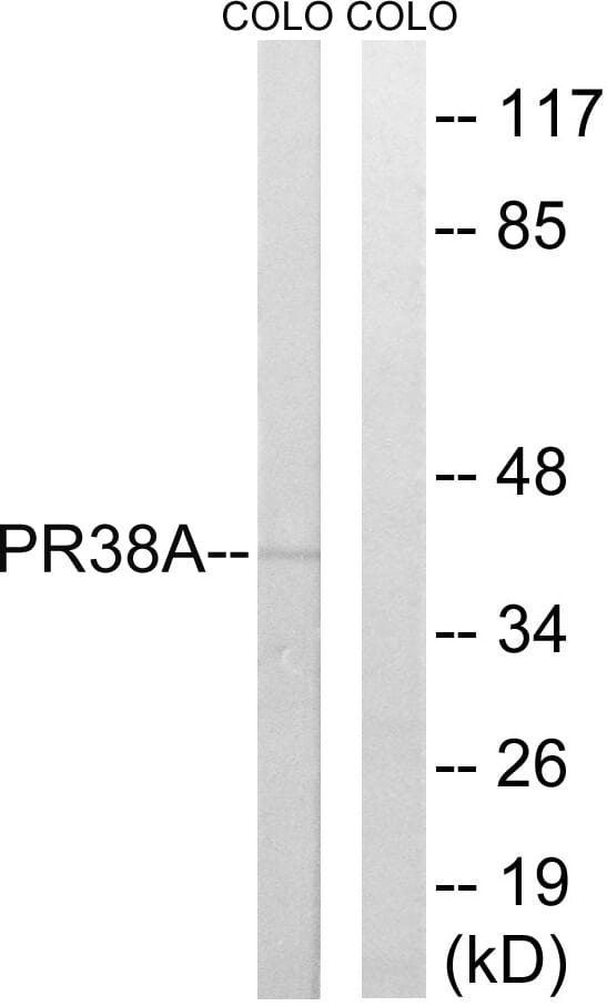 Western blot analysis of lysates from COLO cells using Anti-PRPF38A Antibody. The right hand lane represents a negative control, where the antibody is blocked by the immunising peptide.