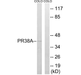 Western Blot - Anti-PRPF38A Antibody (C17853) - Antibodies.com