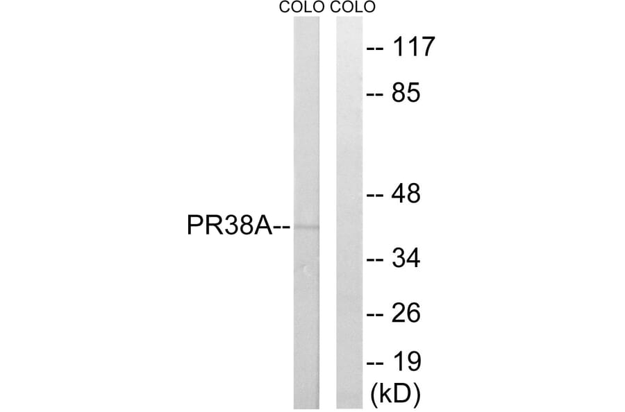 Western Blot - Anti-PRPF38A Antibody (C17853) - Antibodies.com