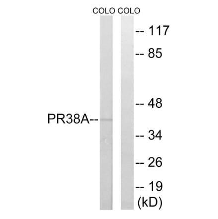 Western Blot - Anti-PRPF38A Antibody (C17853) - Antibodies.com