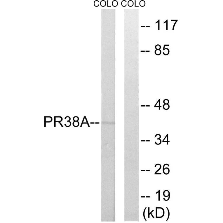 Western Blot - Anti-PRPF38A Antibody (C17853) - Antibodies.com