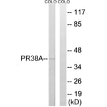 Western Blot - Anti-PRPF38A Antibody (C17853) - Antibodies.com