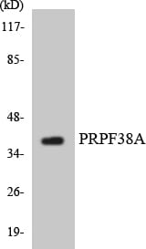 Western blot analysis of the lysates from HUVEC cells using Anti-PRPF38A Antibody.