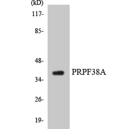 Western Blot - Anti-PRPF38A Antibody (R12-3372) - Antibodies.com