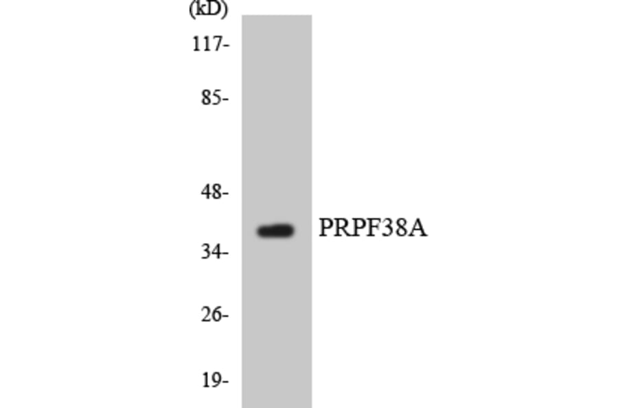 Western Blot - Anti-PRPF38A Antibody (R12-3372) - Antibodies.com